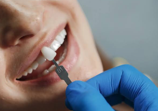 Why Preventive Dentistry Extends The Life Of Whitening And Veneers